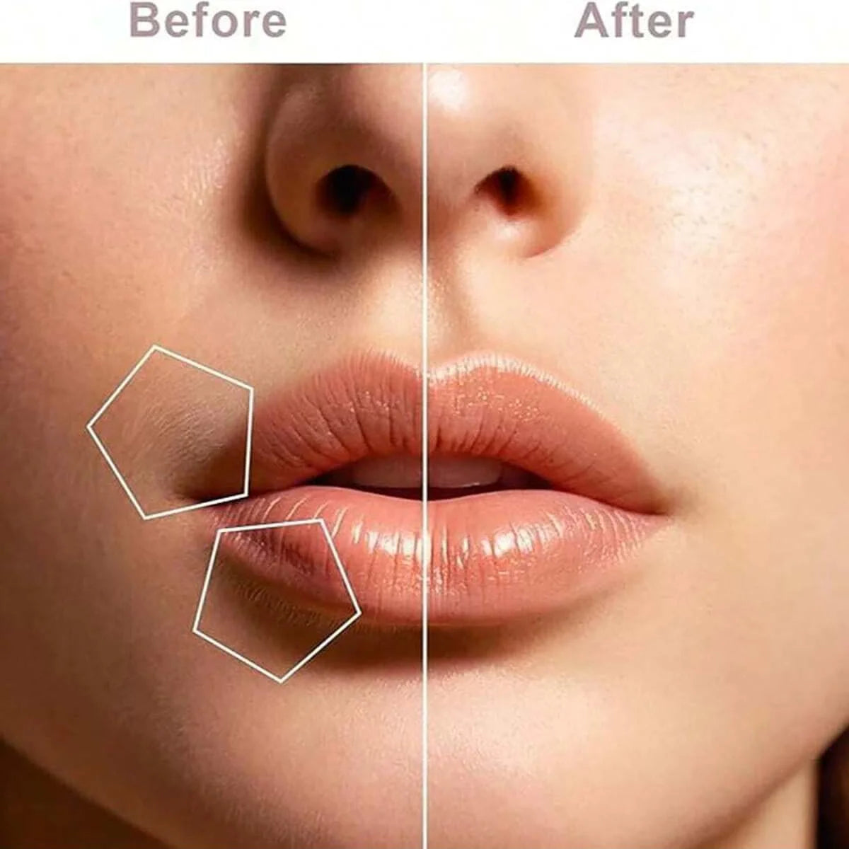 Women's Facial Hair Remover